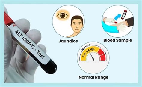 SGPT Test – Normal & High Ranges, Uses, Results, Causes & Symptoms.